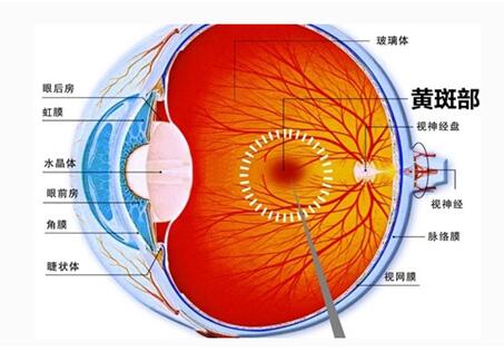 眼底充血如何治疗？